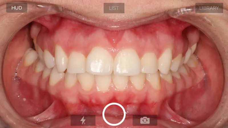 IOC Snapshot Camera screenshot 3 of 3