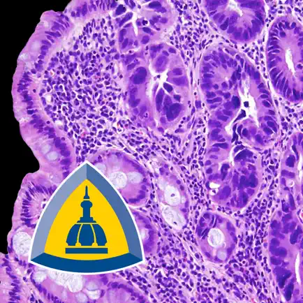 Colonic Pathology Cheats