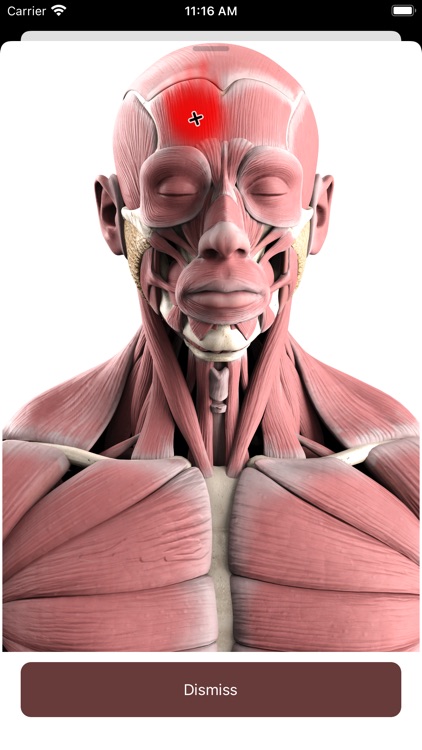 Trigger point - Body