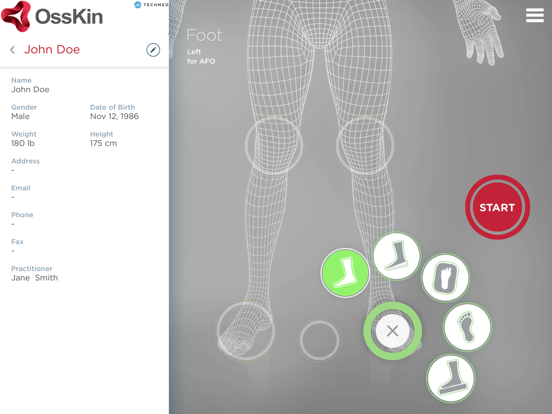 Screenshot #6 pour OssKin 3D Scan