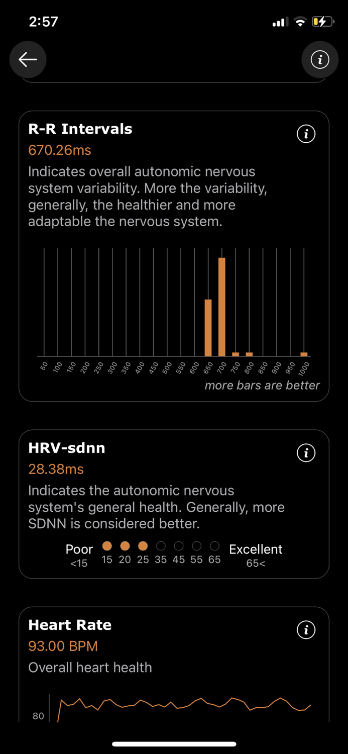 ECG heart analyze - watch