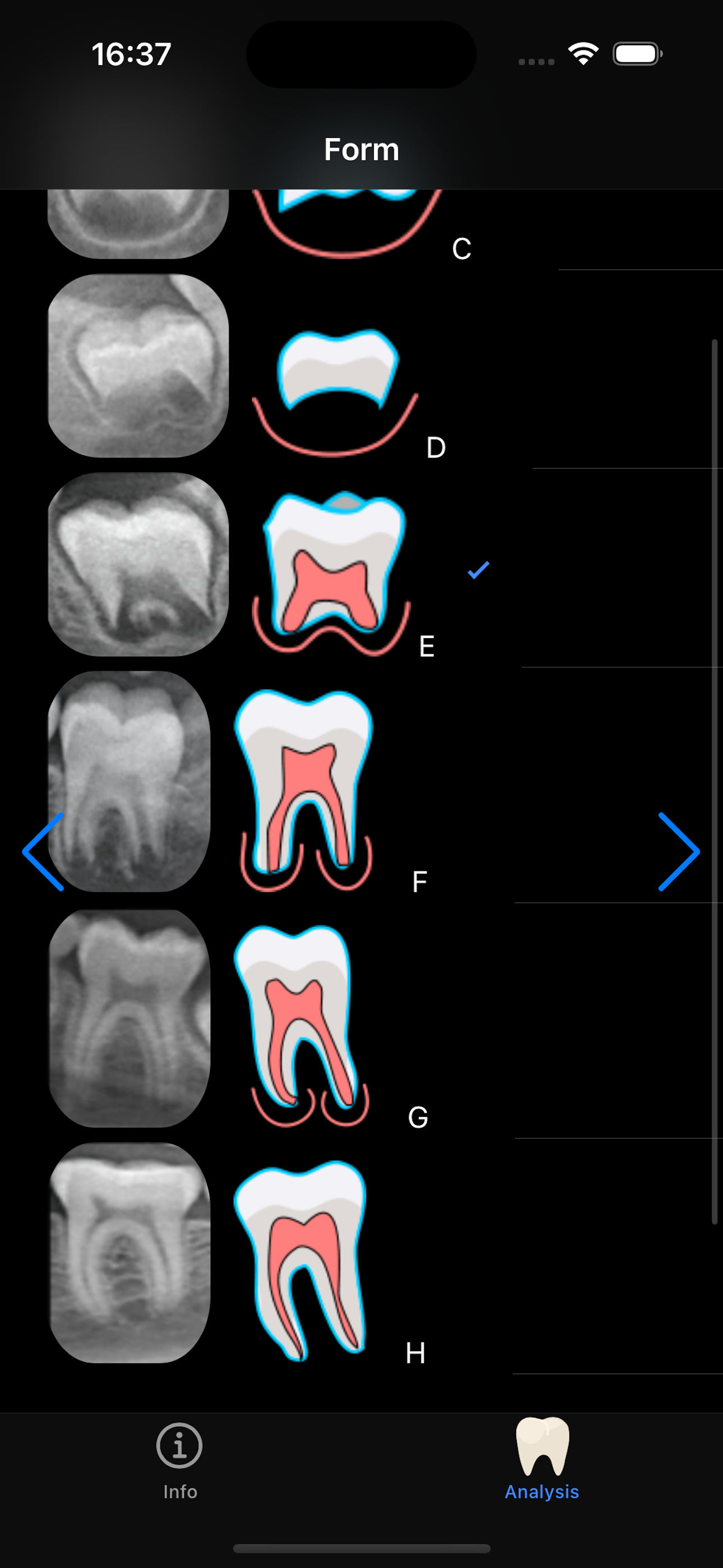 Dental Age
