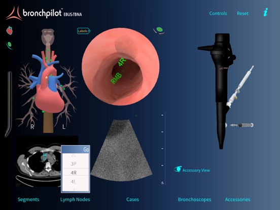 Screenshot #6 pour BronchPilot EBUS-TBNA