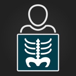 RX - Radiographic Positioning