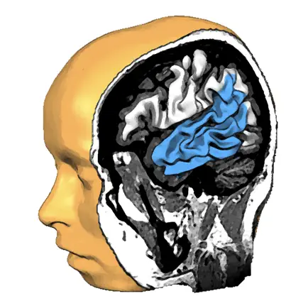 Brain Tutor 3D Cheats