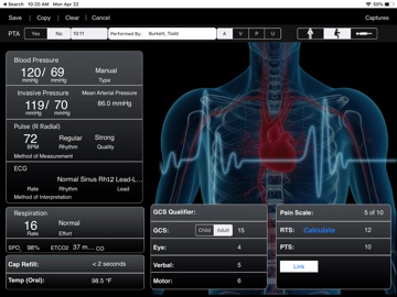 iPCR Insight app screenshot