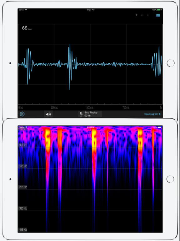 電子聴診器 ＆ 聴診法のおすすめ画像1