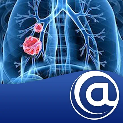 Non-Small Cell Lung Cancer Cheats