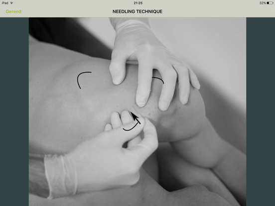 Dry Needling Guide iPad screenshot 3 - Medical app