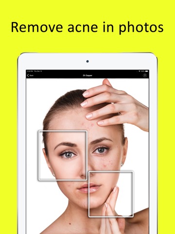 Zit Zapper - Remove Pimplesのおすすめ画像1