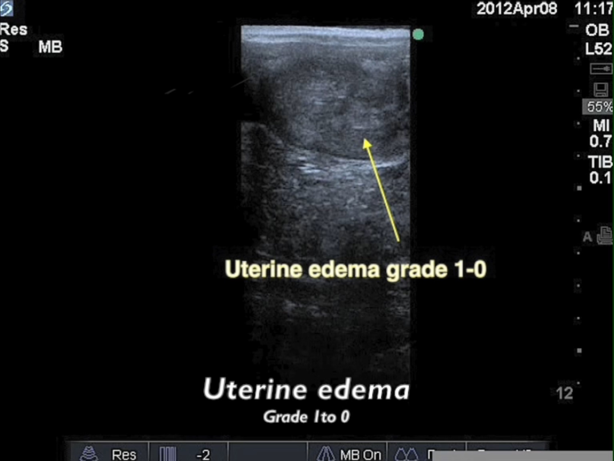 Equine Reproductive Ultrasound screenshot 2