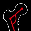NeckShaftAngle App icon