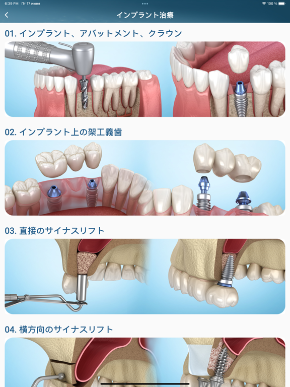 Dental 3D Illustrationsのおすすめ画像3