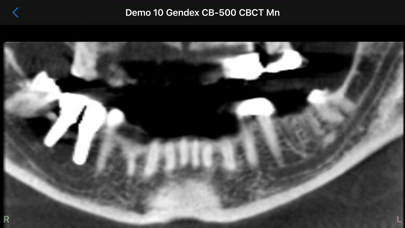 Dental CT View Screenshot