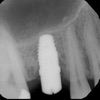 Dental ML icon