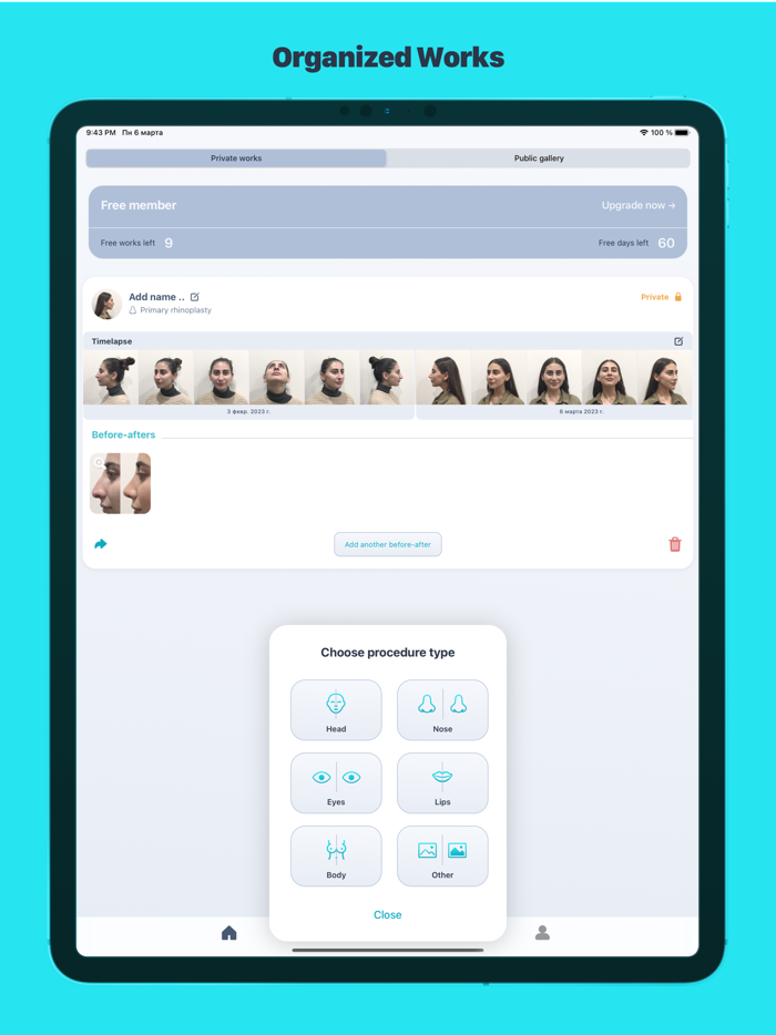 iMed CS  Before-After Editor