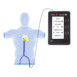 Temporary Cardiac Pacing