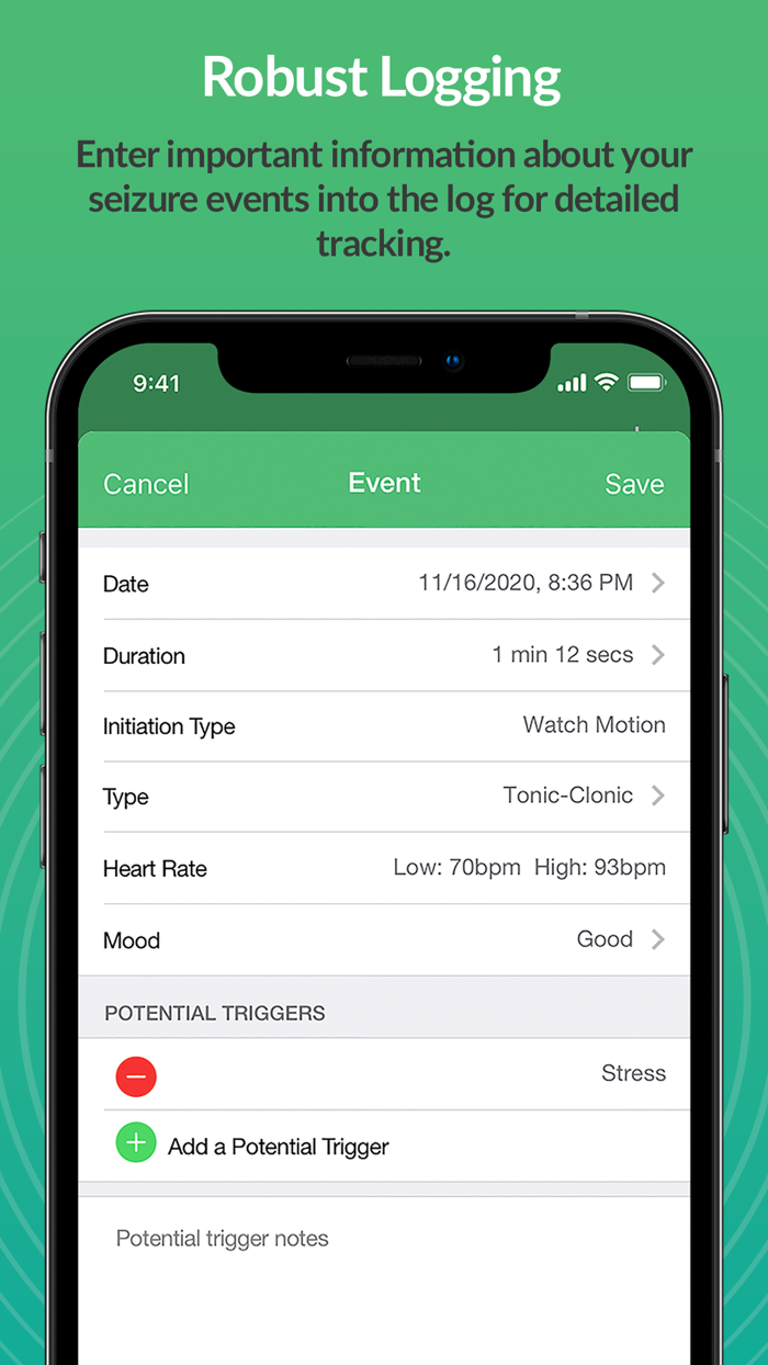 SeizAlarm Seizure Detection