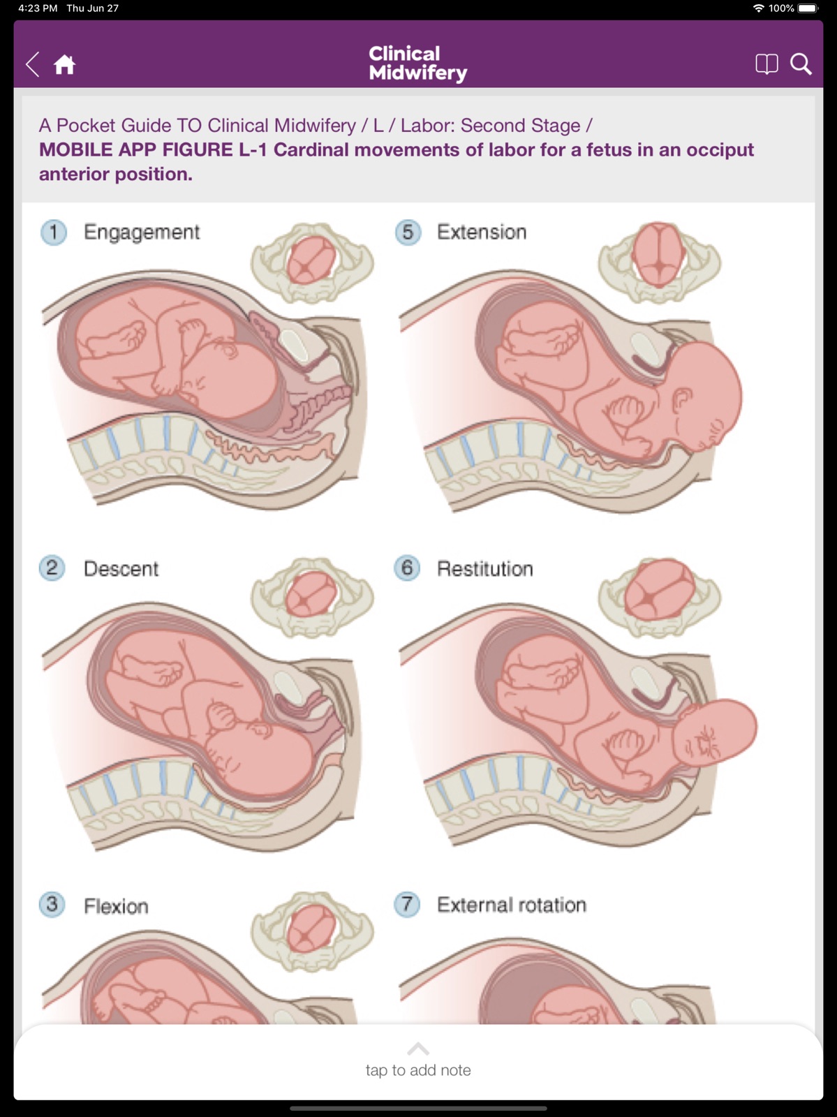 Guide to Clinical Midwifery ipad screenshot 2