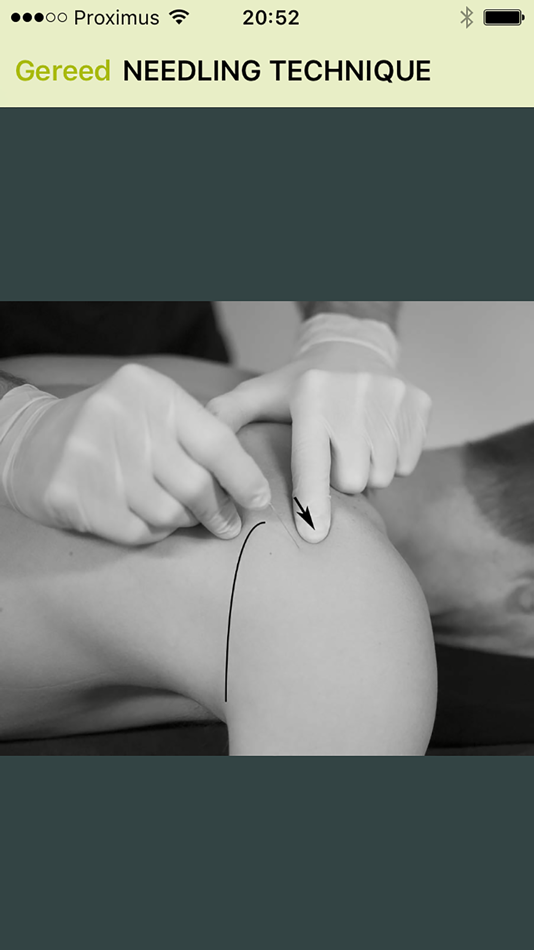 #4. Dry Needling Guide (iOS) 由: BarB BVBA