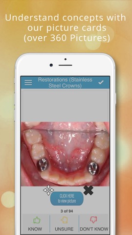 Pediatric Dentistry Cram Cardsのおすすめ画像2