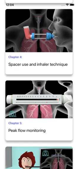 Game screenshot ASTHMAXcel PRO apk