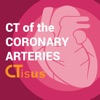 CTisus CT Coronary Arteries - iPadアプリ