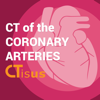 CTisus CT Coronary Arteries - Elliot Fishman