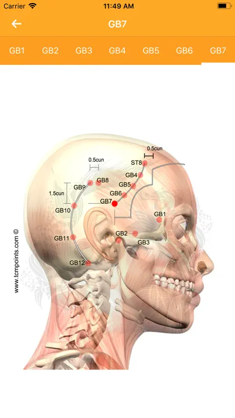 Acupuncture Assistant