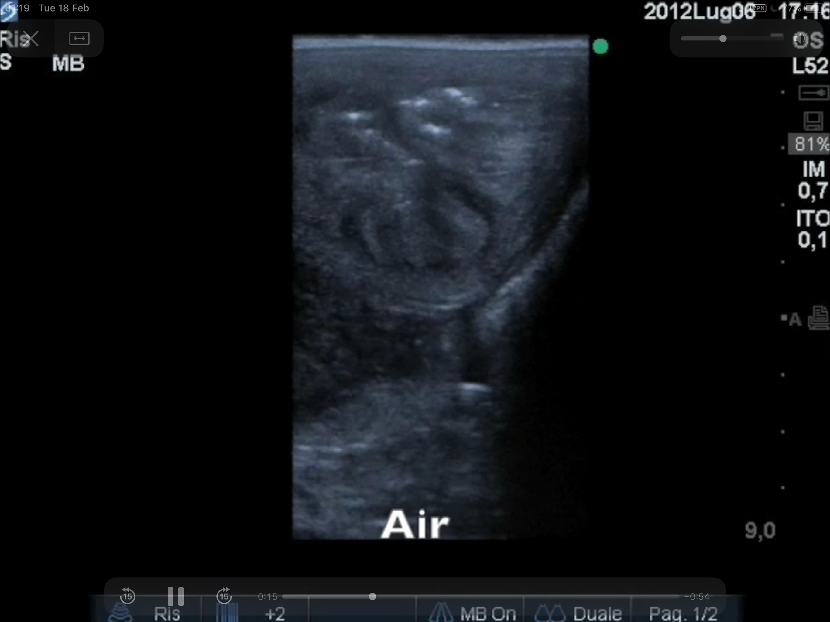 Equine Reproductive Ultrasound screenshot 8