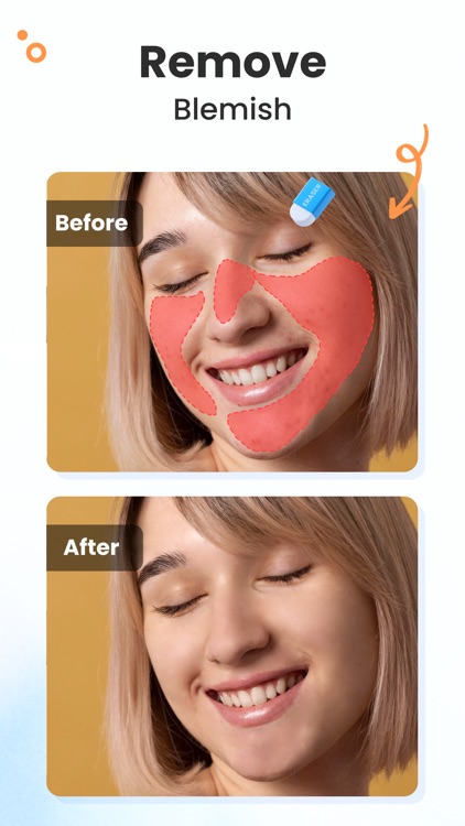 Remove Objects: Photo enhancer screenshot-6