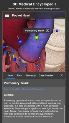 Pocket Heart screenshot 3