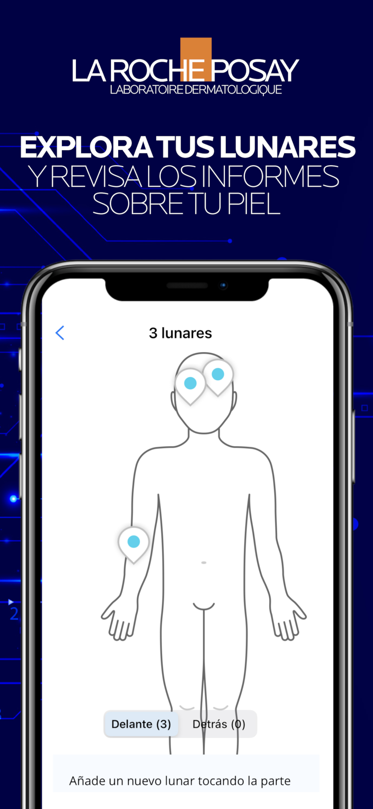 SkinVision - Cáncer de piel