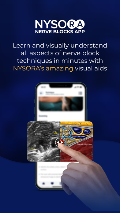 NYSORA Nerve Blocks Screenshot