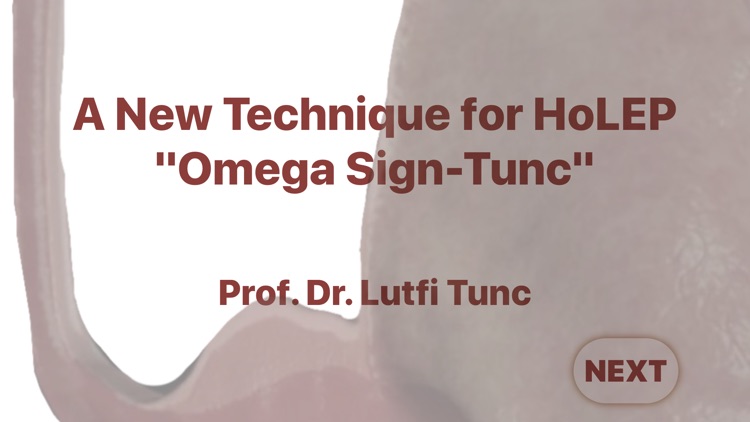 Omega Sign Tunc