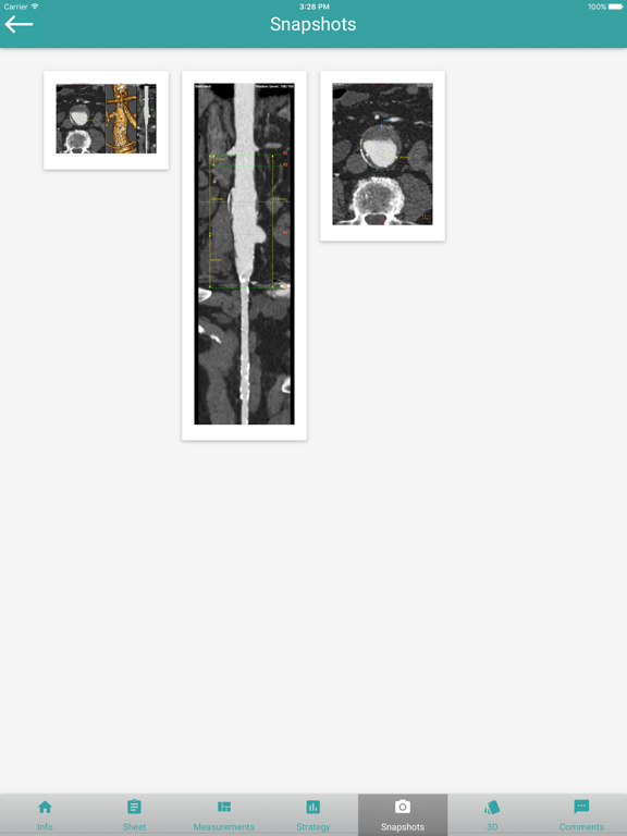 Screenshot #6 pour EndoSizeMe