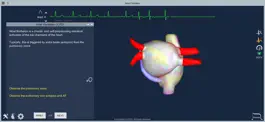 Game screenshot Atrial Fibrillation apk