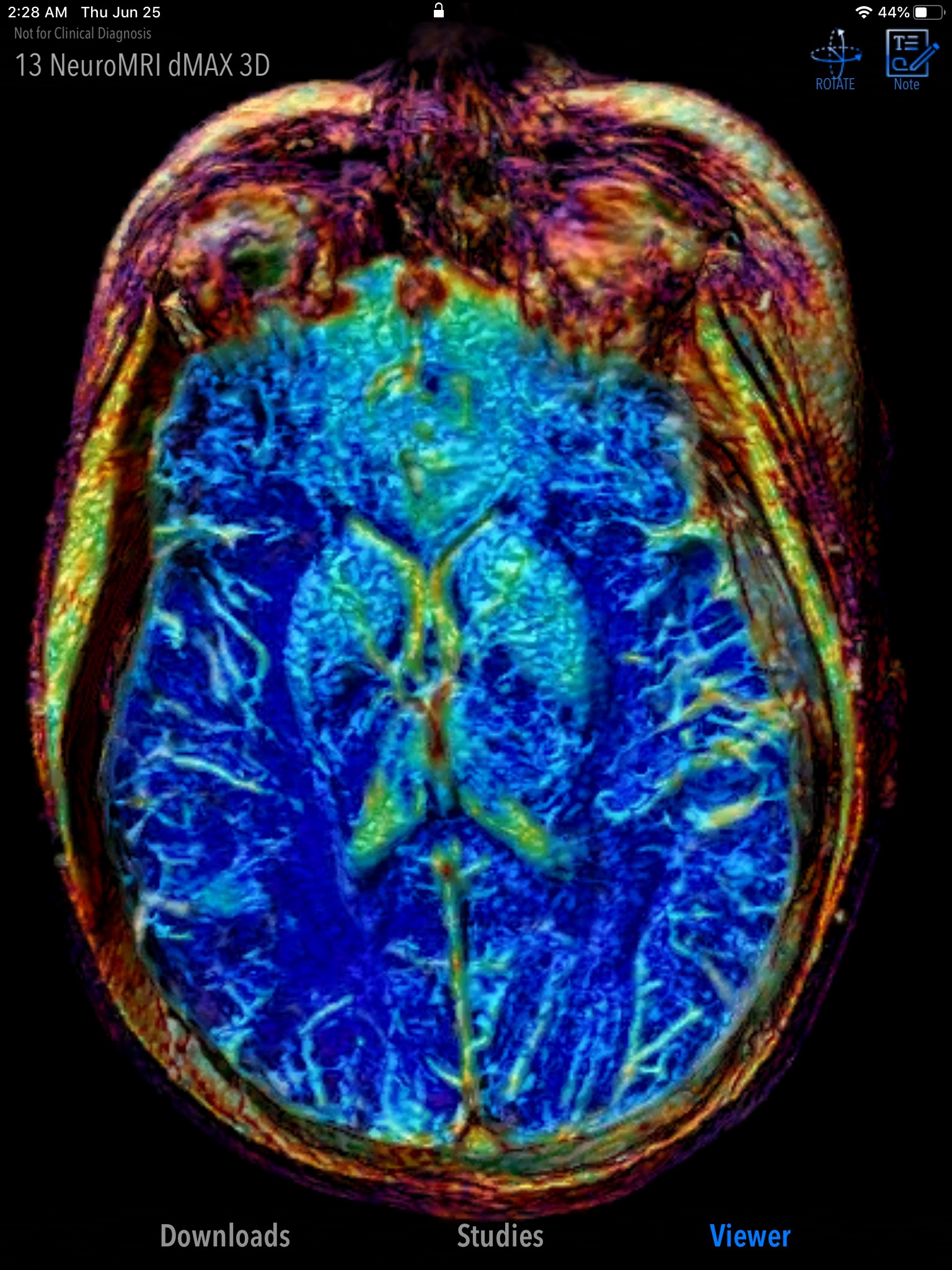 MedVizi™ CT-MRI Viewer screenshot 3