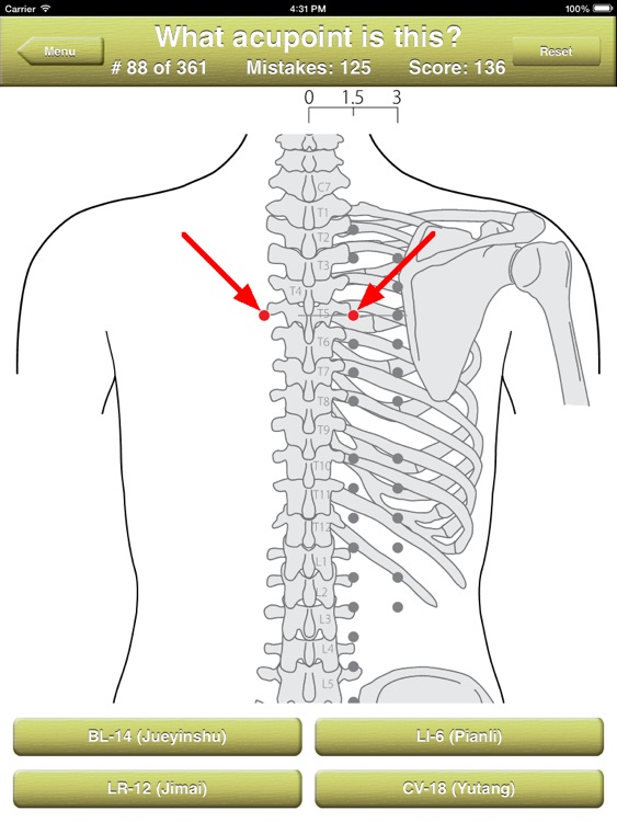 Acupoints Location Quiz screenshot-3
