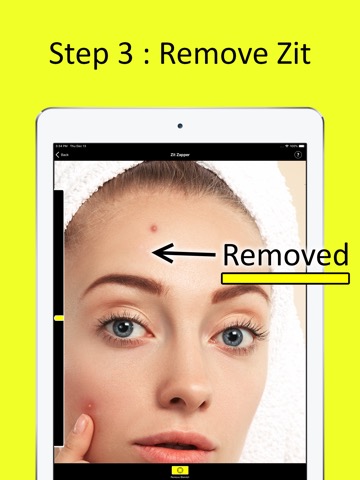 Zit Zapper - Remove Pimplesのおすすめ画像4