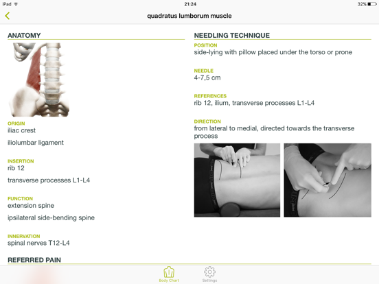 Dry Needling Guide iPad screenshot 2 - Medical app