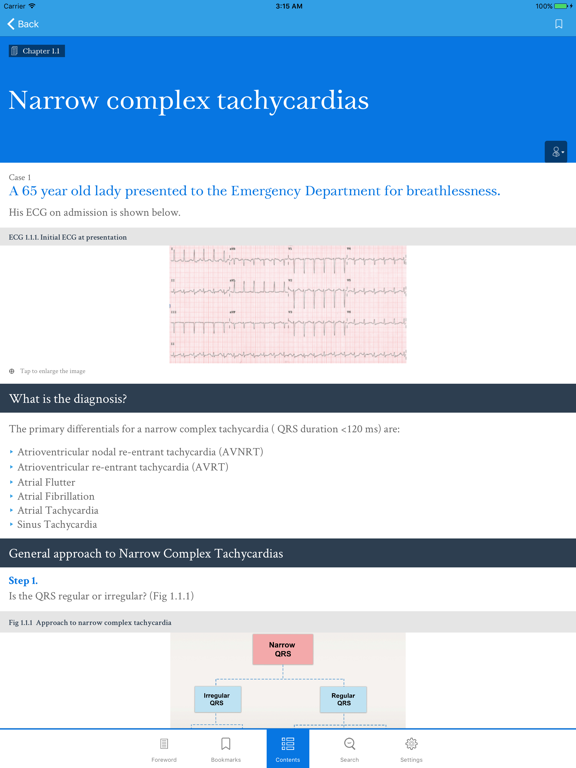 Screenshot #5 pour Dr ECG