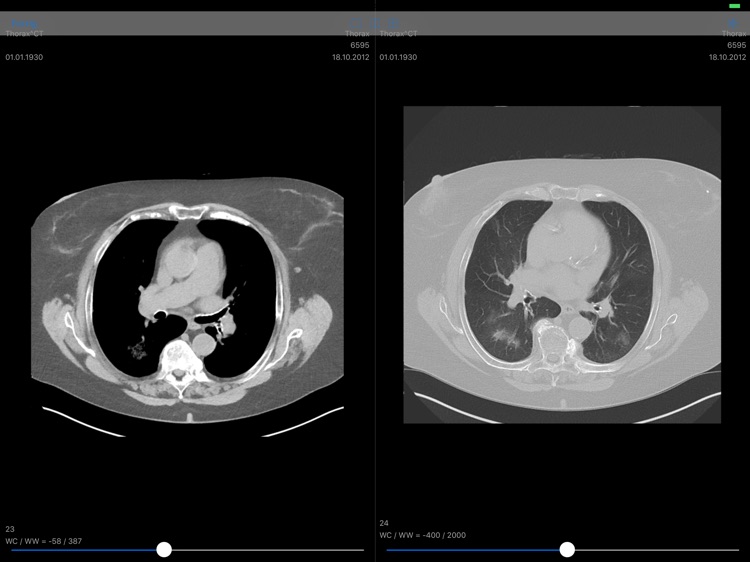 Allgeier.PACS Mobile