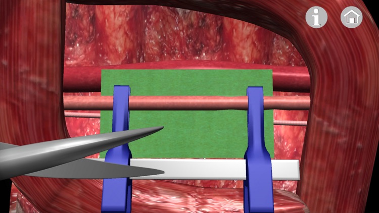 Microsurgery 3D (Ad Version)