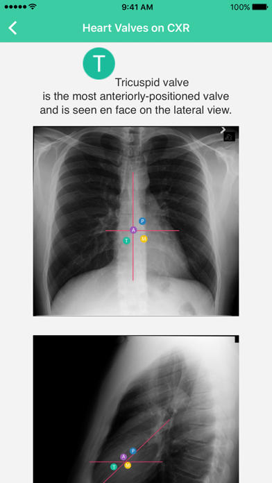 Screenshot #10 for Radiology Toolbox Pro