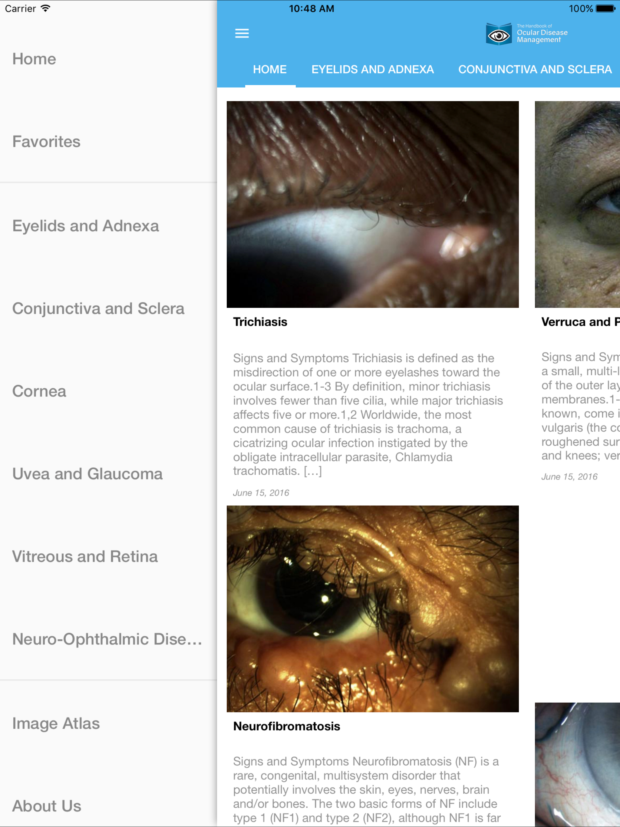 Ocular Disease Handbook screenshot 7