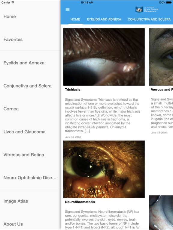 Screenshot #6 pour Ocular Disease Handbook
