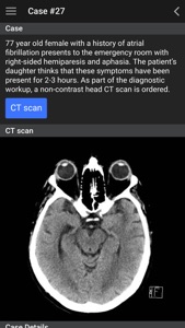 UBC Radiology screenshot #5 for iPhone