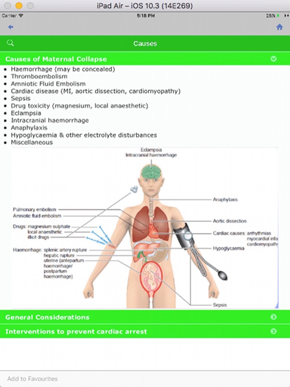 Screenshot #5 pour Rotunda Anaesthesia