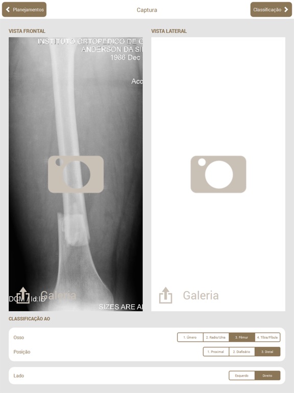 Osteotraumaのおすすめ画像1